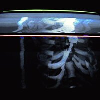 Bones - BadNews (ПлохиеНовости)