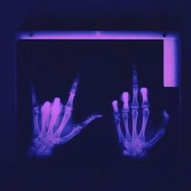 YAWNS - Take My Chain