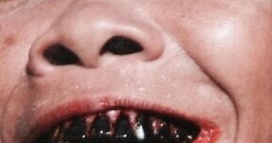 $uicideBoy$, Germ - Hepatitis G