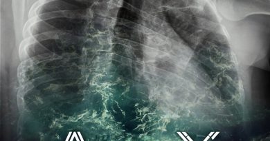 Asper X - Море